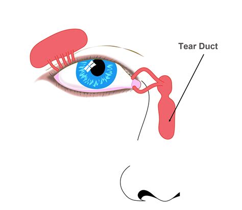 hole in tear duct